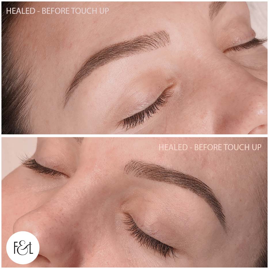 healed brows