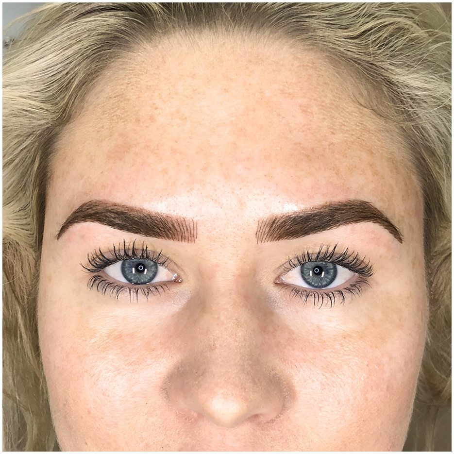 alana-combination-cosmetic-eyebrow-tattoo
