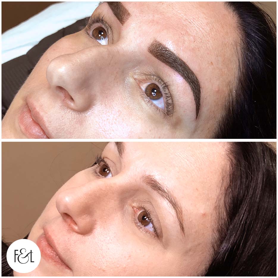 abby before and after brows