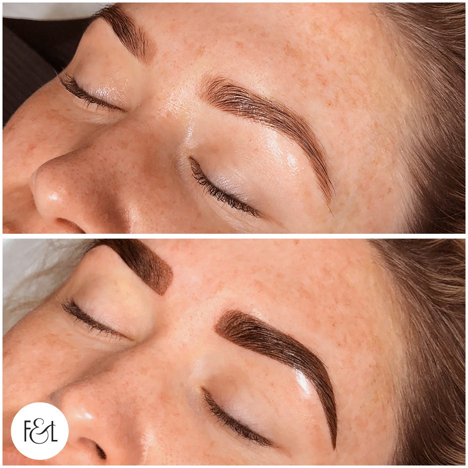 alana 12 month refresh after