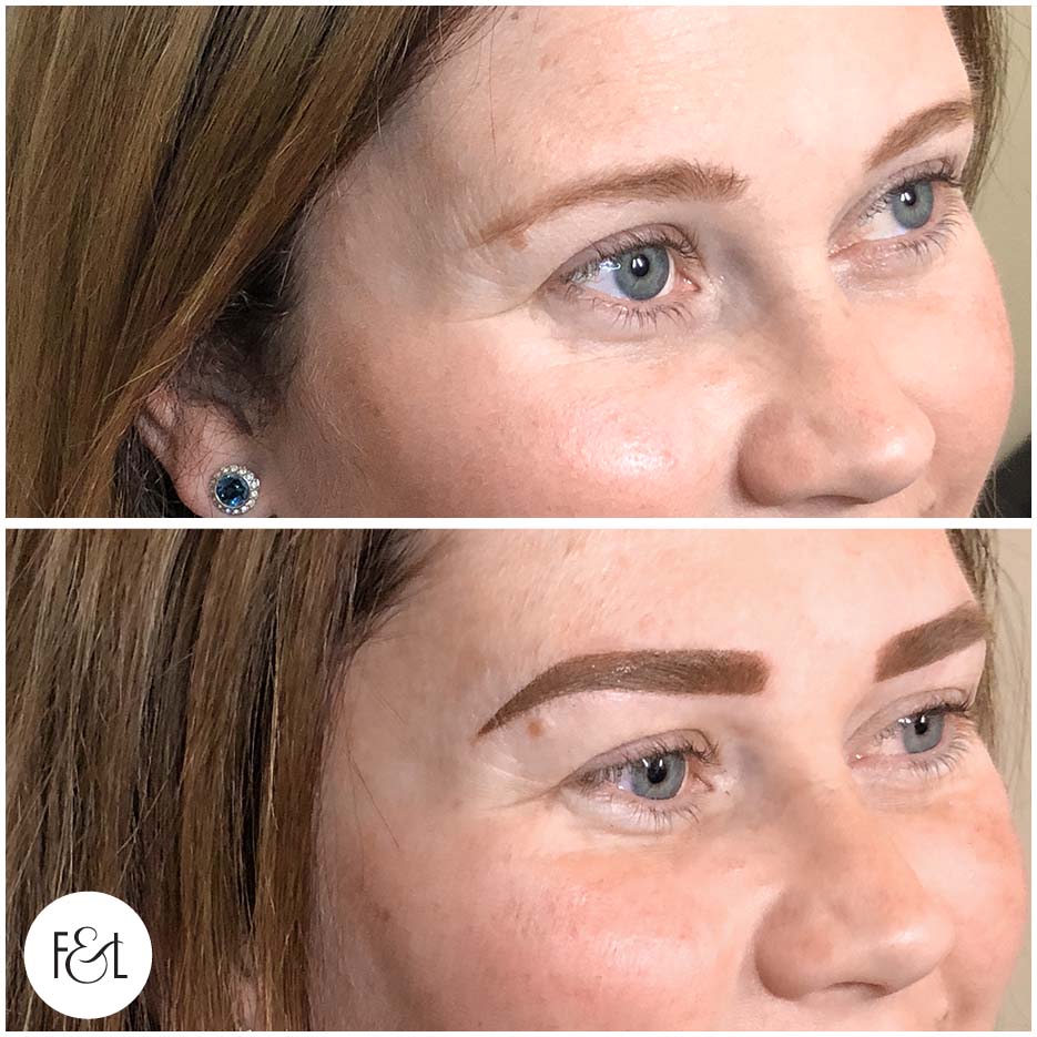 jenny before and after brows