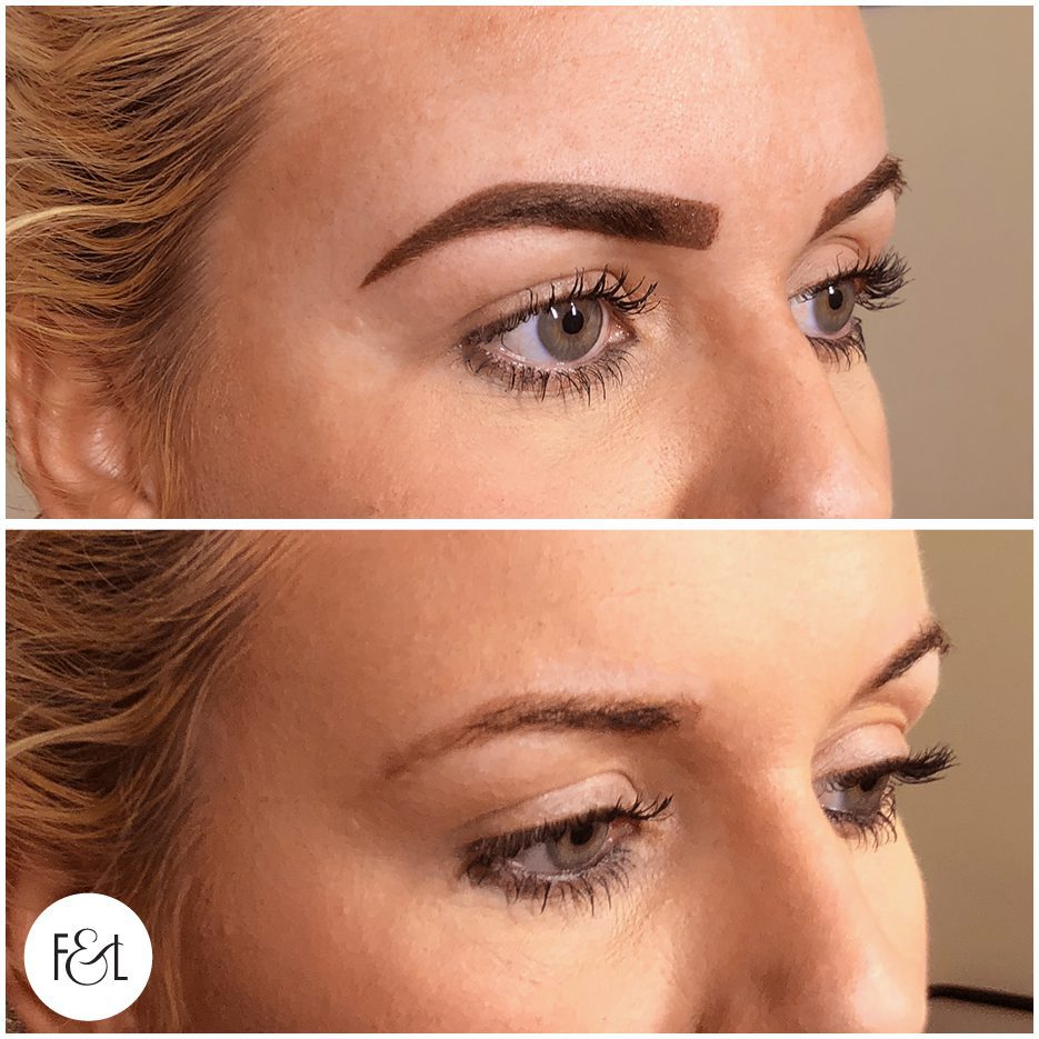Kyla before and after brows