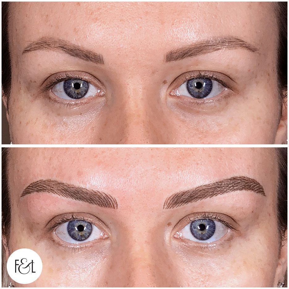 combo brows before and after