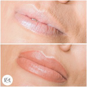 Ang lips Lip Blush Tattoo - Before and After