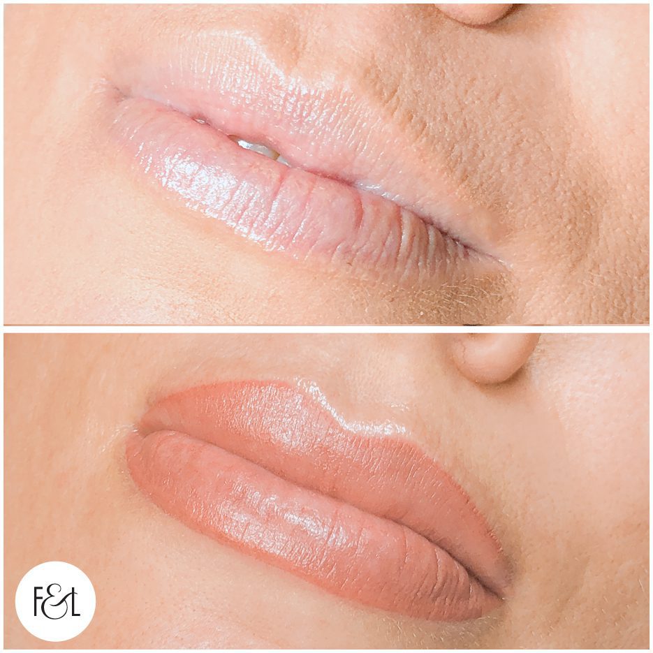 Ang lips Lip Blush Tattoo - Before and After