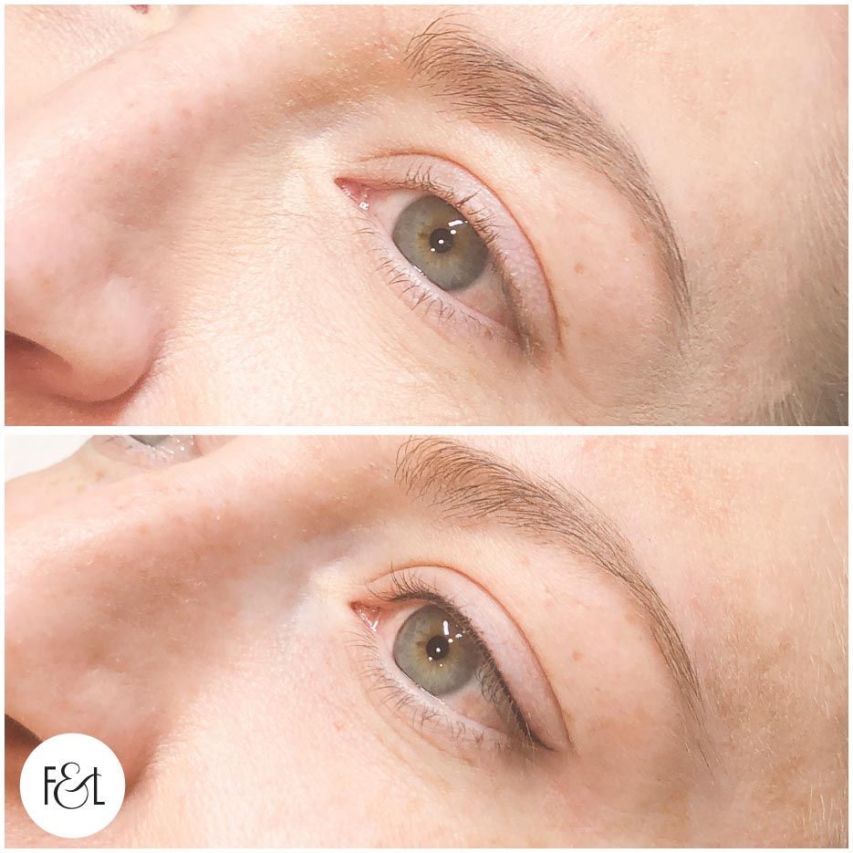 suzy eyes2 Petite Flick Eyeliner Tattoo - Before and immediately after