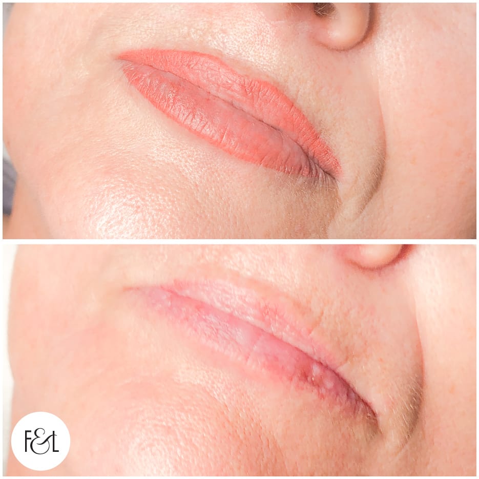 Jodie Lips B&A cosmetic tattoo lips - before and after