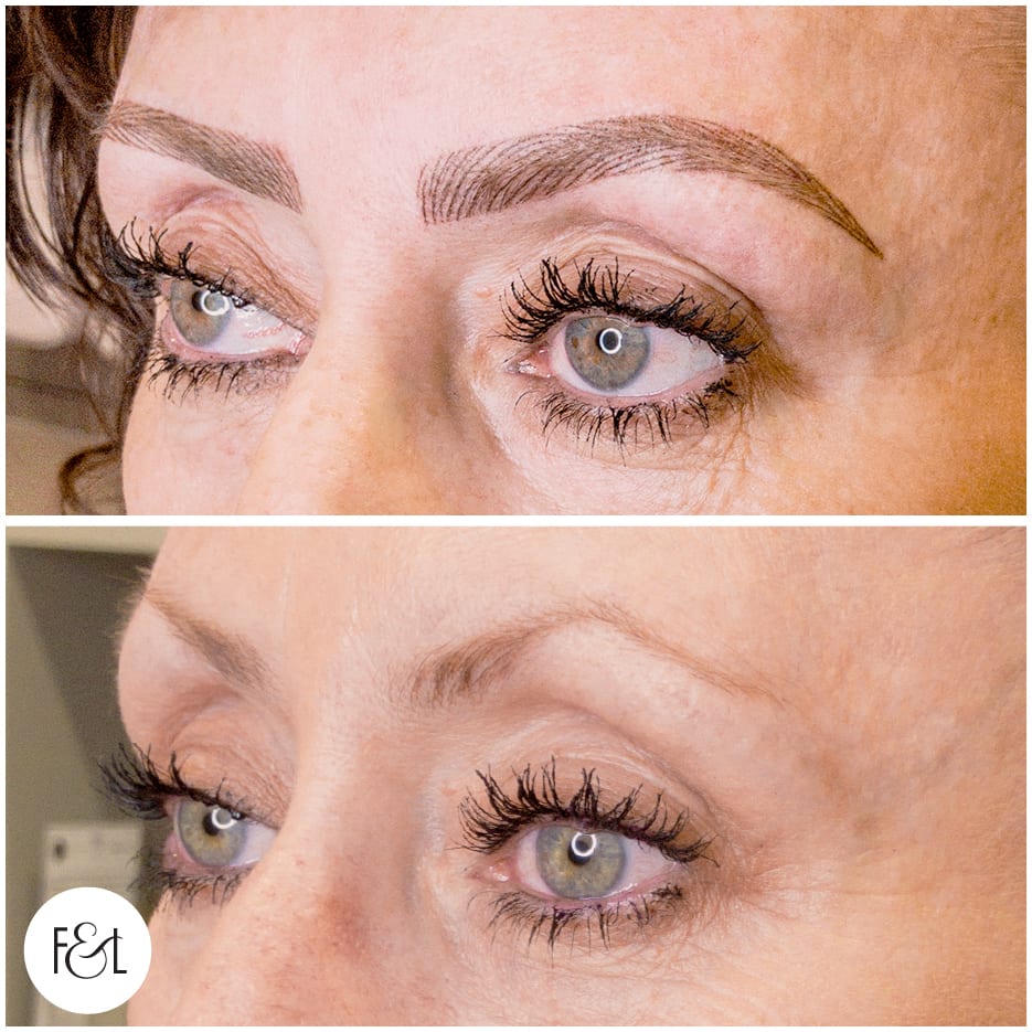 Before and after cosmetic tattoo feather touch